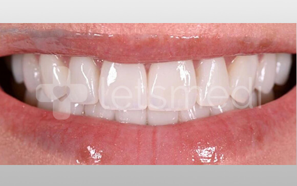 before-after-images (10)