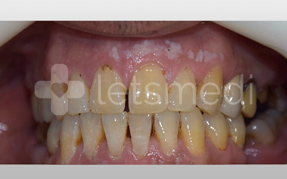 before-after-images (4)