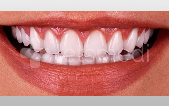 before-after-images (6)