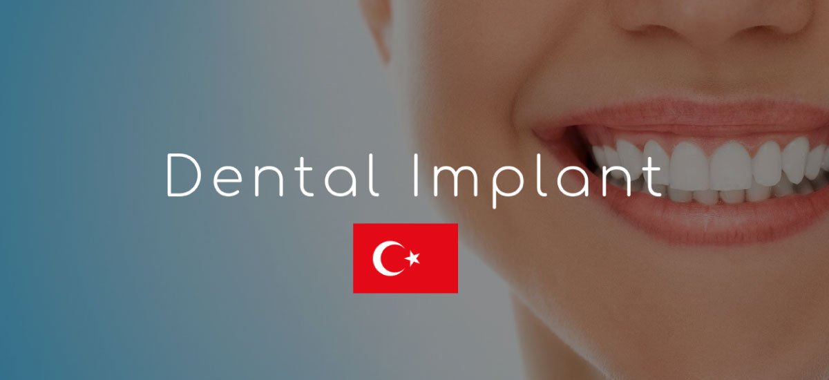 Full mouth dental implants cost Turkey .