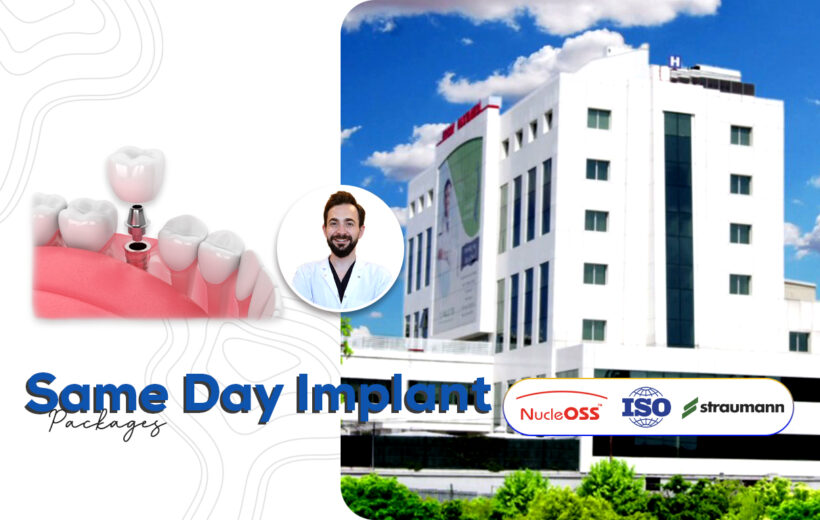Same Day Implant