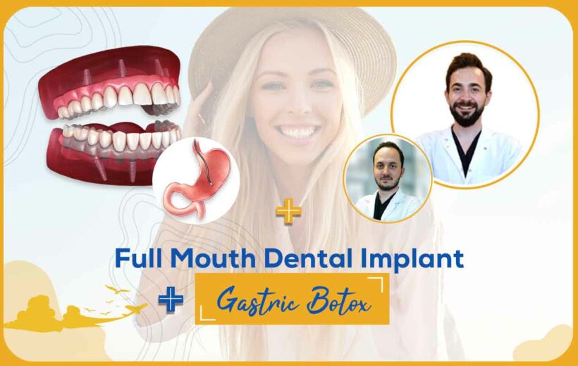 Full Mouth Dental Implant-Gastric Botox