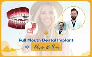 Full Mouth Dental Implant-Elipse Balloon
