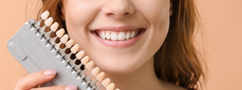 How Much Do E-Max Veneers Cost