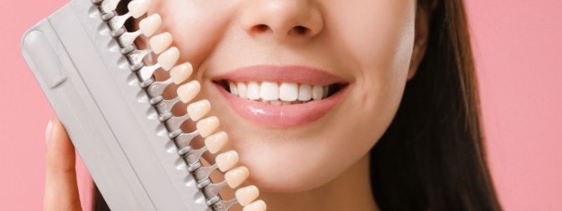 How Much Will Composite Veneers Cost Me