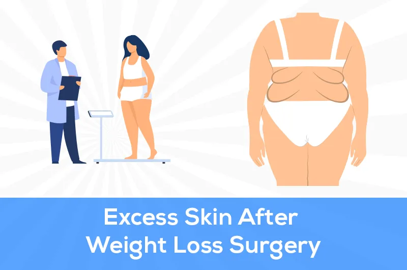 excess skin after weight loss surgery