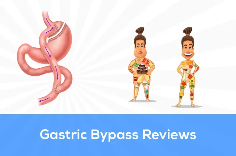 gastric bypass reviews
