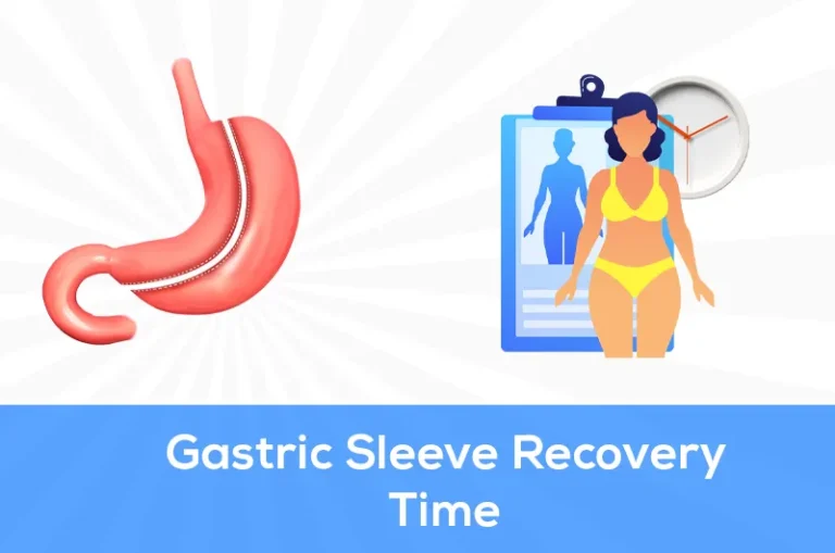 gastric sleeve recovery time