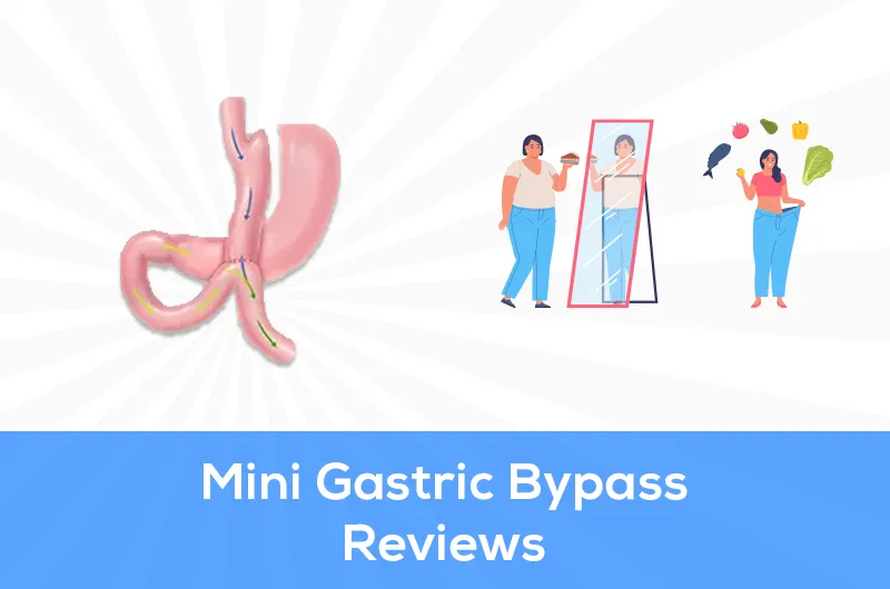 mini gastric bypass reviews
