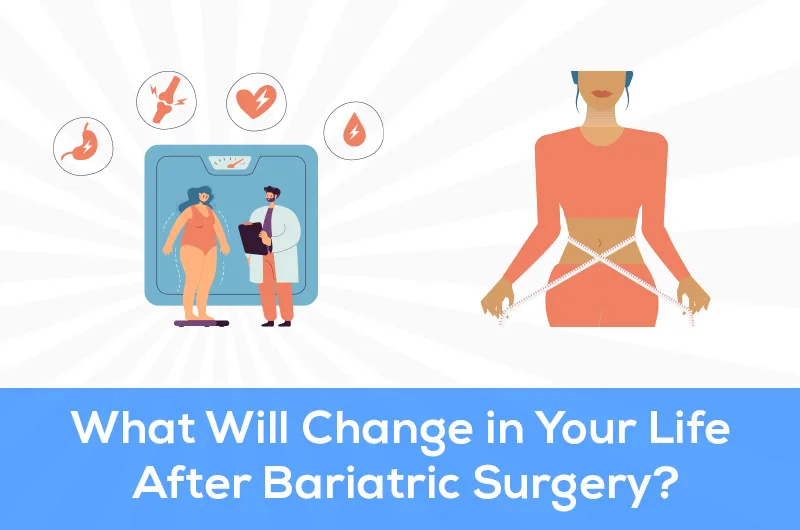 what Will change in our life after bariatric surgery