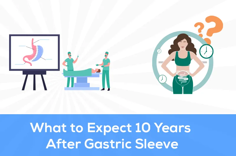 What to Expect 10 Years After Gastric Sleeve