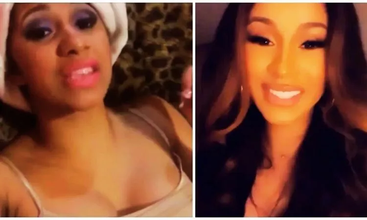Cardi B Veneers before and after