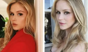 Erin Moriarty's Facial Surgery: Before and After