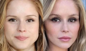 Erin Moriarty's Lip Surgery: Before and After