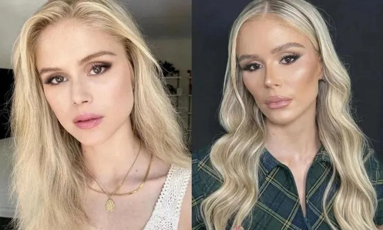 Erin Moriarty's Nose Surgery: Before and After