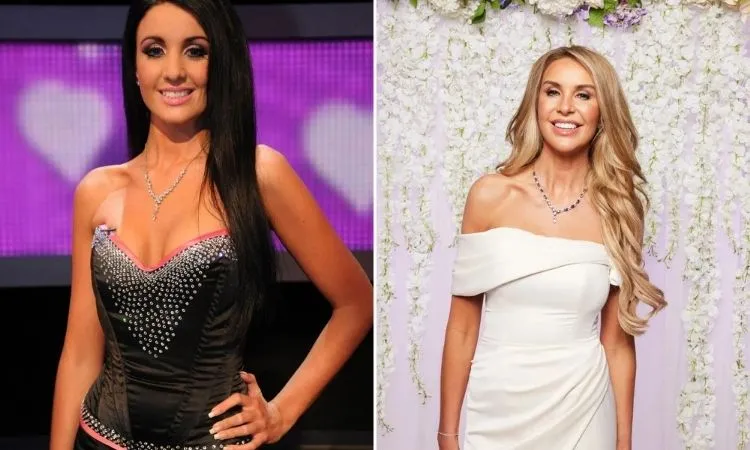 Peggy Rose plastic surgery before and after