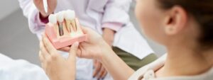Are dental implants permanent?