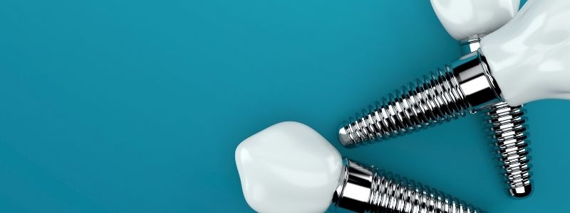 Can I get a tooth implant years later?