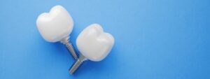 Do Gums Grow Around Implants?