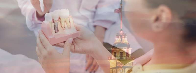 Should I go to Turkey for dental implants?