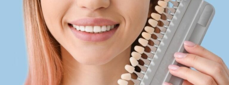 Zahnveneers Arten » Welche Zahnveneers-Arten gibt es?