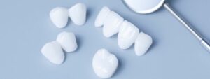 How Much Do Porcelain Veneers Cost