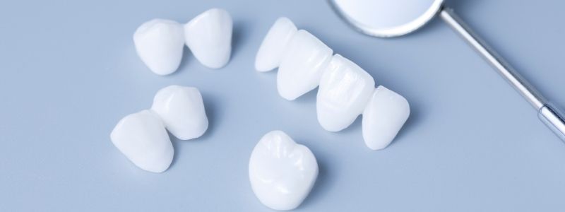 How Much Do Porcelain Veneers Cost?