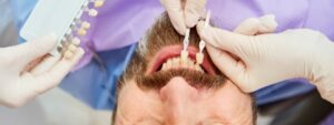 Wann werden Veneers eingesetzt?