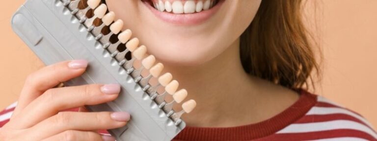 Was sind Veneers?