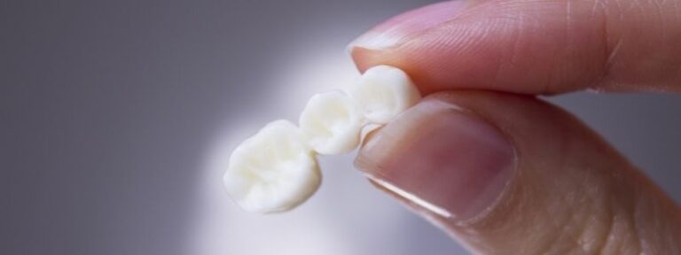Wie oft kann man eine Zahnkrone erneuern?