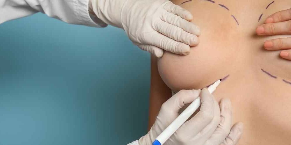 Breast Lift Abroad