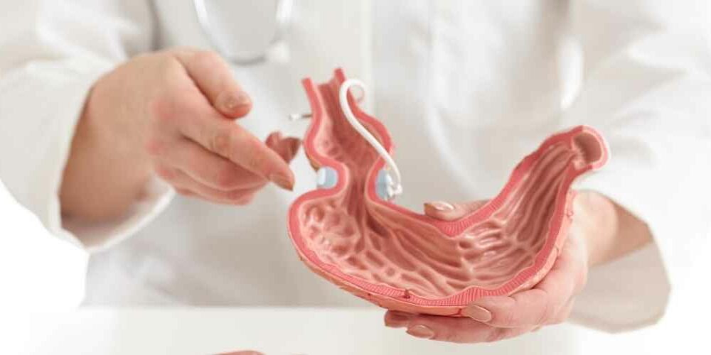 Gastric Bypass Abroad