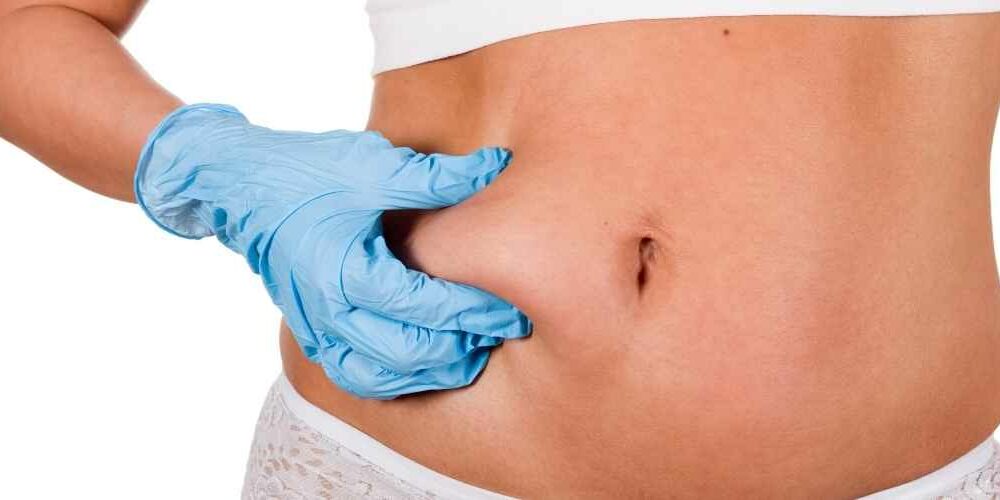 Liposuction Abroad