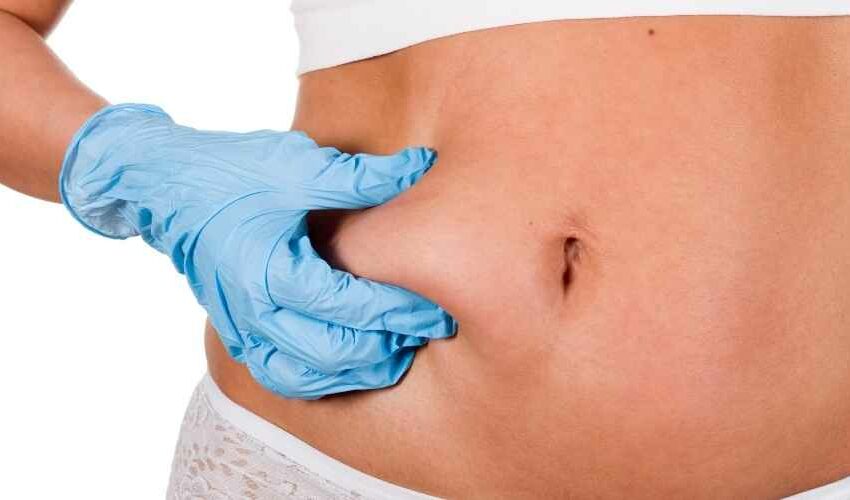 Liposuction Abroad