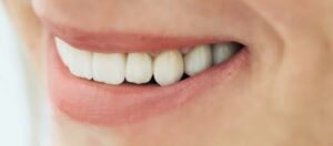 Zirkonium Veneers Erfahrungen
