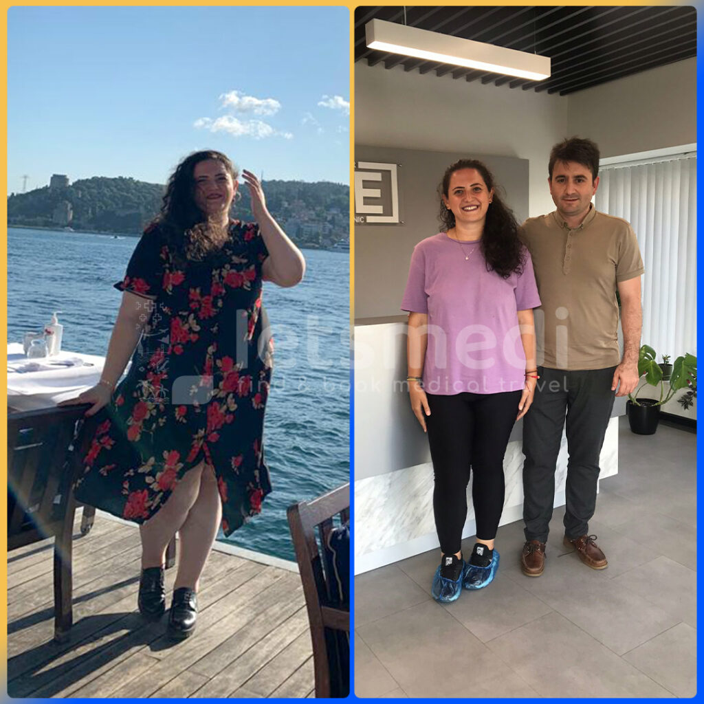 Mommy Makeover in Istanbul, Turkey • Cost & Reviews in 2023 Letsmedi