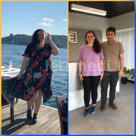 Mommy Makeover in Istanbul, Turkey • Cost & Reviews in 2023 - Letsmedi