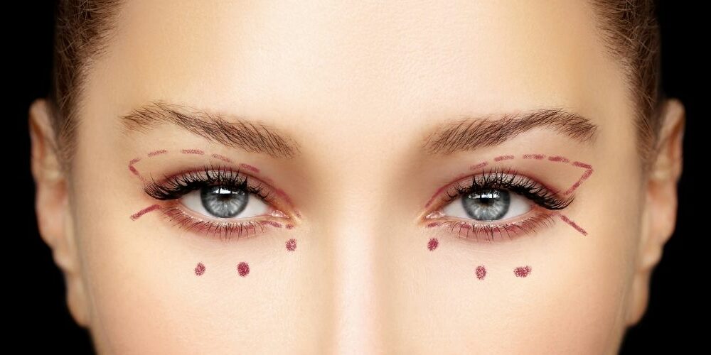 Blepharoplasty Cost in the UK