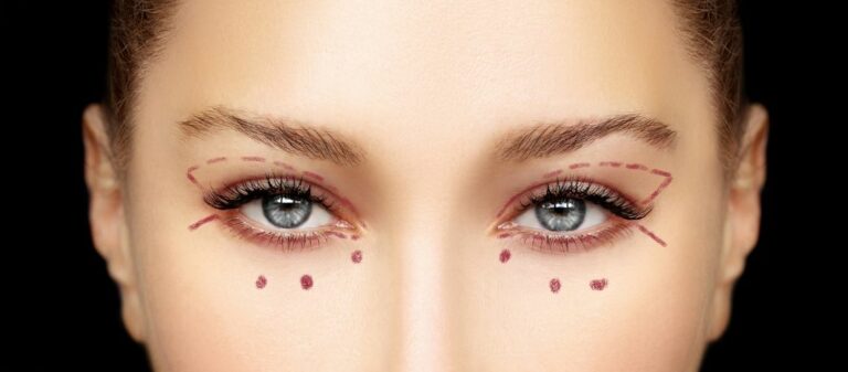 Blepharoplasty Cost in the UK