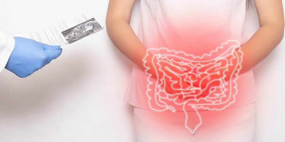 Duodenal Switch Surgery Cost in UK
