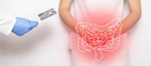 Duodenal Switch Surgery Cost in UK