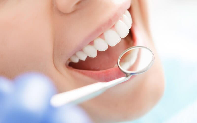 dental-implants-cost-turkey