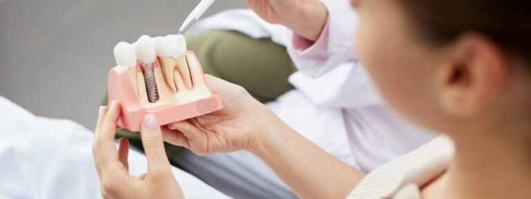 What is the best age for a dental implant?