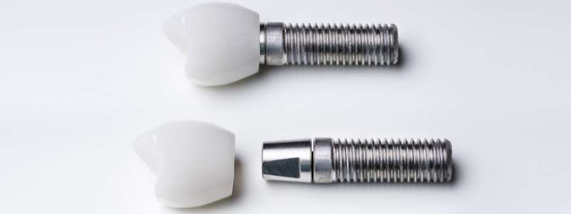 Recovery after Full Mouth Dental Implants