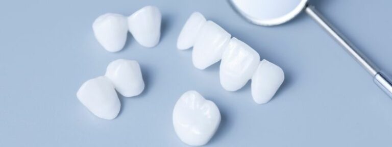 How Much Do Porcelain Veneers Cost?