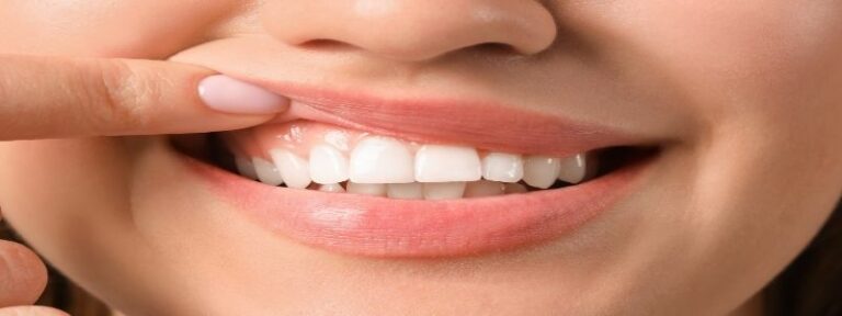 Weißes Zahnfleisch nach Implantat