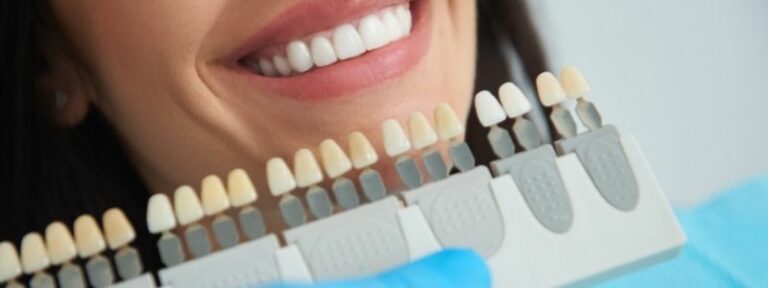 Zahnkrone erneuern wie ist der Ablauf