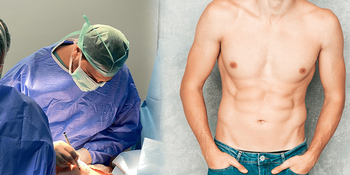 Gynecomastia Surgery in Turkey with Dr. Çağıl