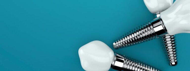 All-on-8-Zahnimplantatkosten in Europa
