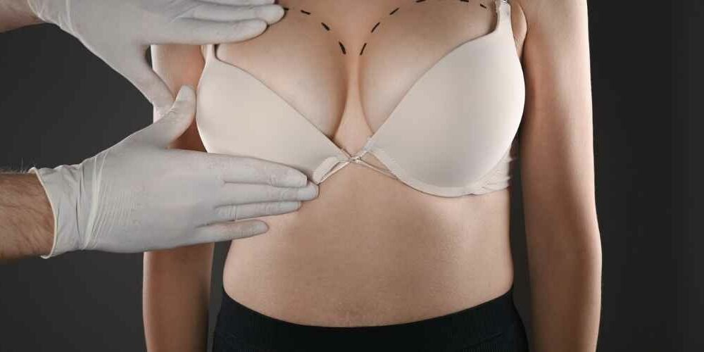 Breast Reduction Abroad